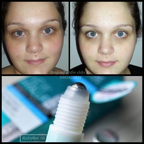 nội địa Nga - lăn mắt Eveline giúp xoá nhăn xoá thâm vùng mắt | BigBuy360 - bigbuy360.vn