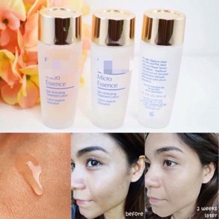 NƯỚC THẦN #ET_Te MICRO ESSENCE SKIN ACTIVATING