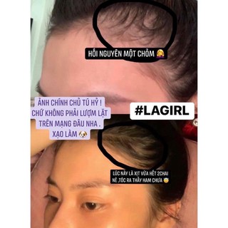 SERUM MỘC KÍCH THÍCH MỌC TÓC