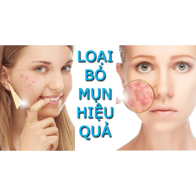 Elfa Pharm Acnacid Rửa mặt kháng khuẩn | BigBuy360 - bigbuy360.vn