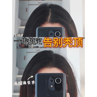  Lược Che Hói Che Khe Da Đầu