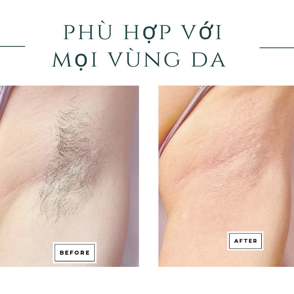 Combo triệt lông sáp wax nóng wax lông, chén silicon, mỡ trăn N'store triệt lông vĩnh viễn vùng nách, bikini, tay chân,