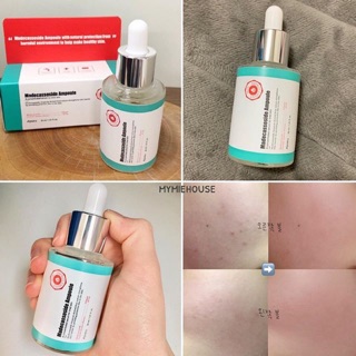 TINH CHẤT DƯỠNG DA MỤN A’PIEU MADECASSOSIDE AMPOULE