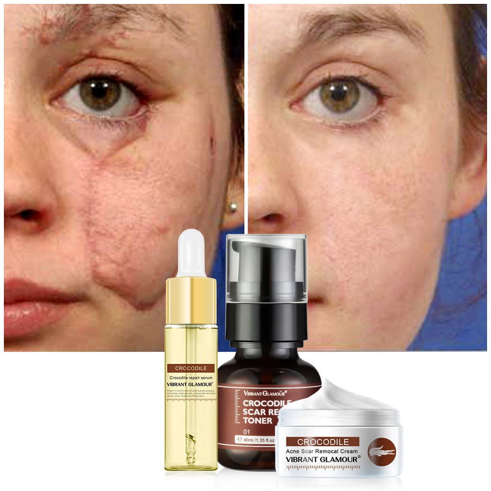 Set 3 Món Serum + Toner + Kem VIBRANT GLAMOUR Dưỡng Ẩm Làm Trắng Hỗ Trợ Mờ Thâm Giảm Sẹo Và Vết Rạn Da | BigBuy360 - bigbuy360.vn