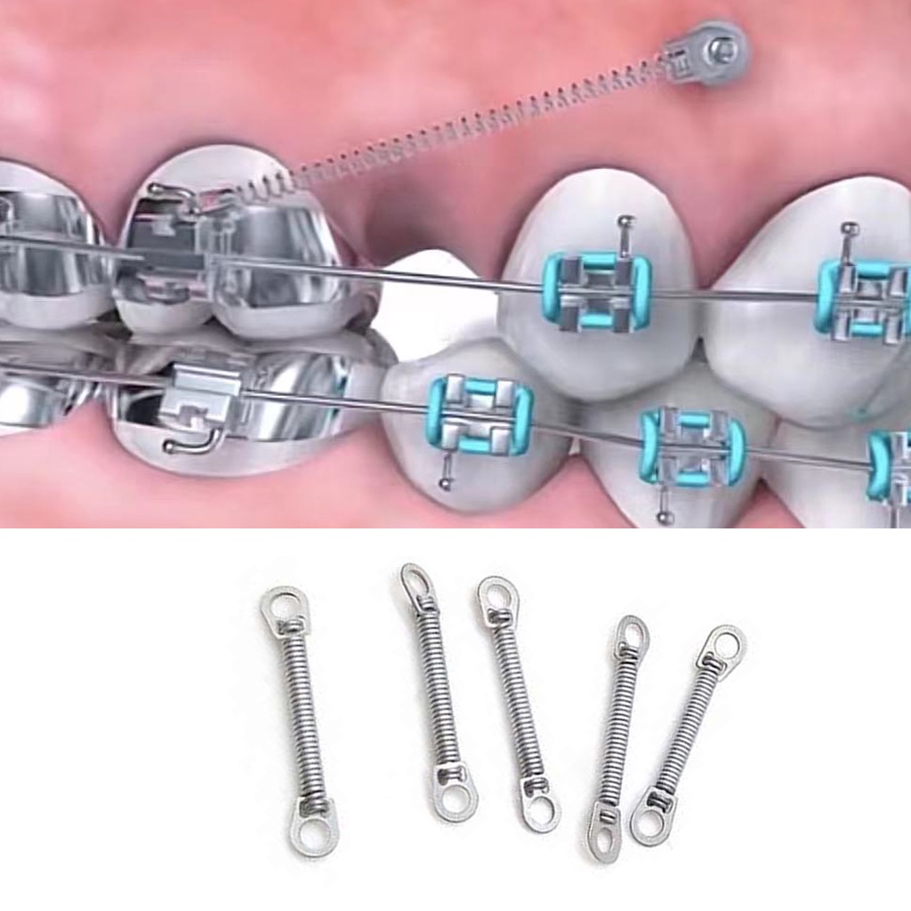 Bộ 10 Lò Xo Chỉnh Nha Chuyên Dụng