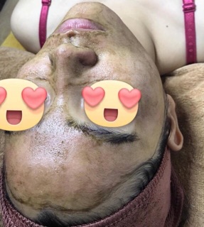 Hộp 10 Set Vi Kim Tảo Biển RONAS Resting Peel