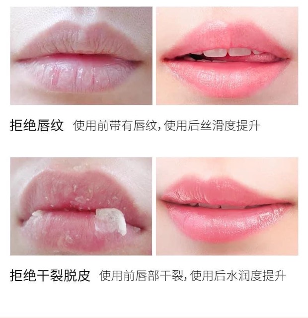 Propolis Lip Mask - Mặt Nạ Dưỡng Ẩm Môi Keo Ong