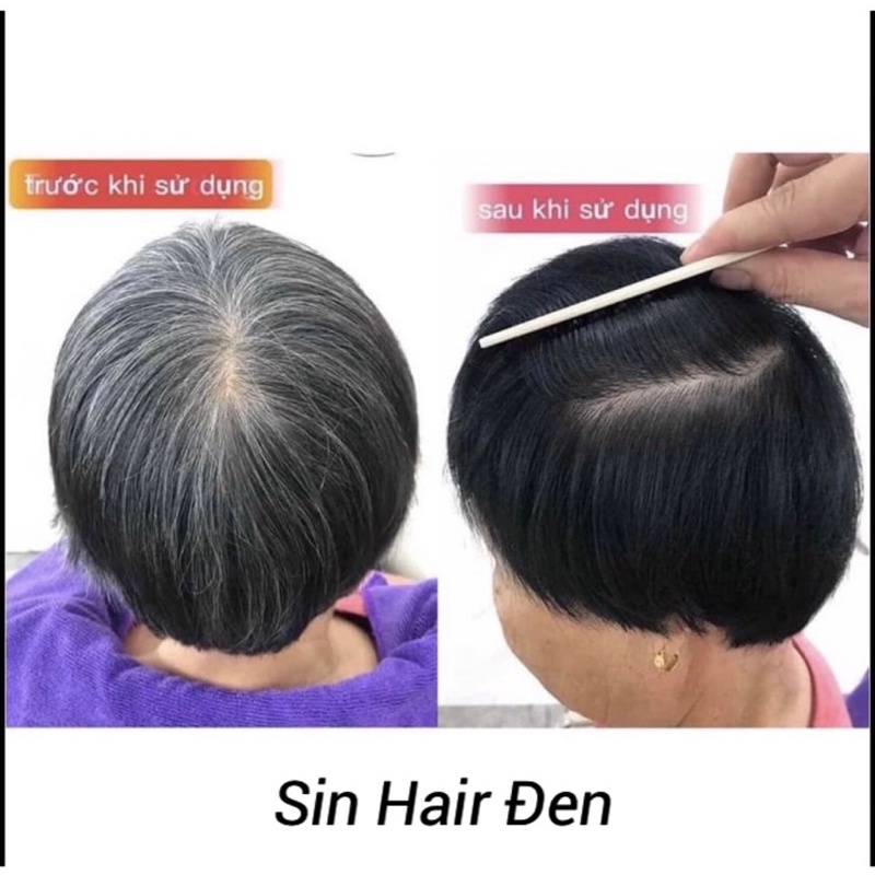 DẦU GỘI PHỦ BẠC ĐEN TÓC NHÂN SÂM SIN HAIR SỐ 1 NHẬT BẢN CAM KẾT CHÍNH HÃNG | BigBuy360 - bigbuy360.vn