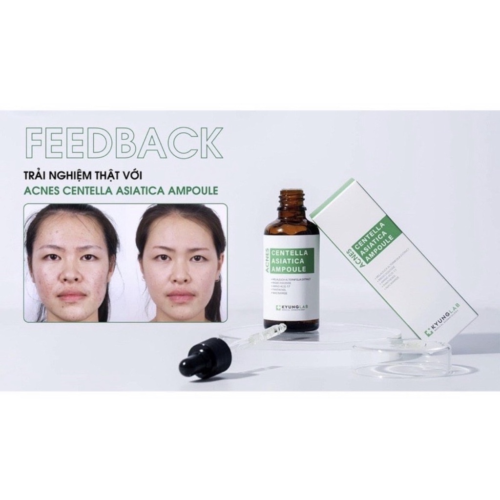 Serum giảm mụn ⚡ GIÁ SỐC ⚡ Tinh chất ngừa mụn Kyung Lab Acnes Centella Asiatica Ampoule 50ml