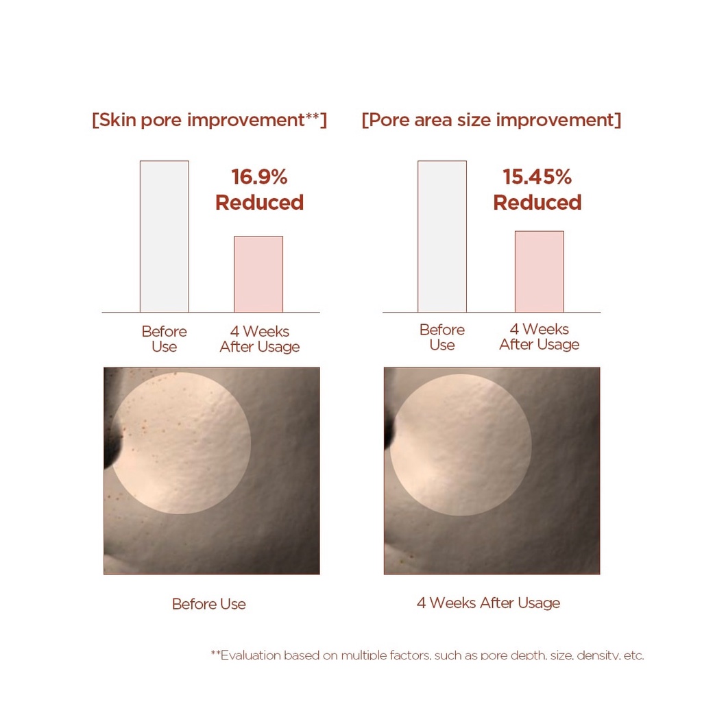 Nước Hoa Hồng Kiểm Soát Dầu Thừa, Se Lỗ Chân Lông Skin1004 Madagascar Centella Poremizing Clear Toner 210ml