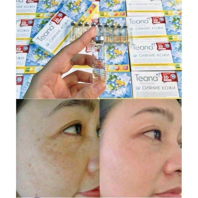 SERUM TEANA C1 MỜ THÂM CĂNG BÓNG DA