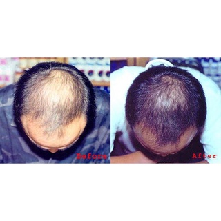 Viên Uống Bổ Sung Vitamin  Mọc Tóc Hairvit