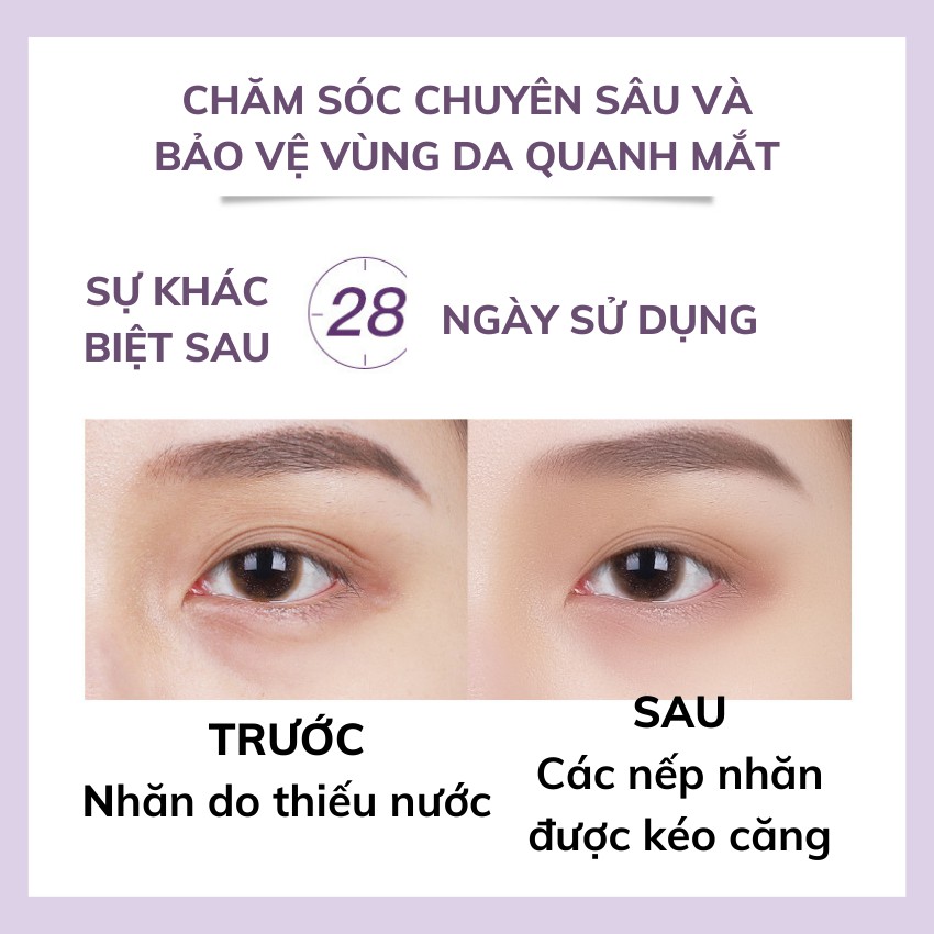 [Giảm Giá 3 Ngày] Kem Mắt Mờ Quầng Thâm KanJN 20g Xóa mờ nếp nhăn da Tan Bọng mắt Pergolden Ka031 | BigBuy360 - bigbuy360.vn
