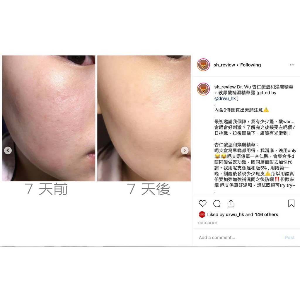 ( Các loại ) Serum Dr wu Mandelic Acid