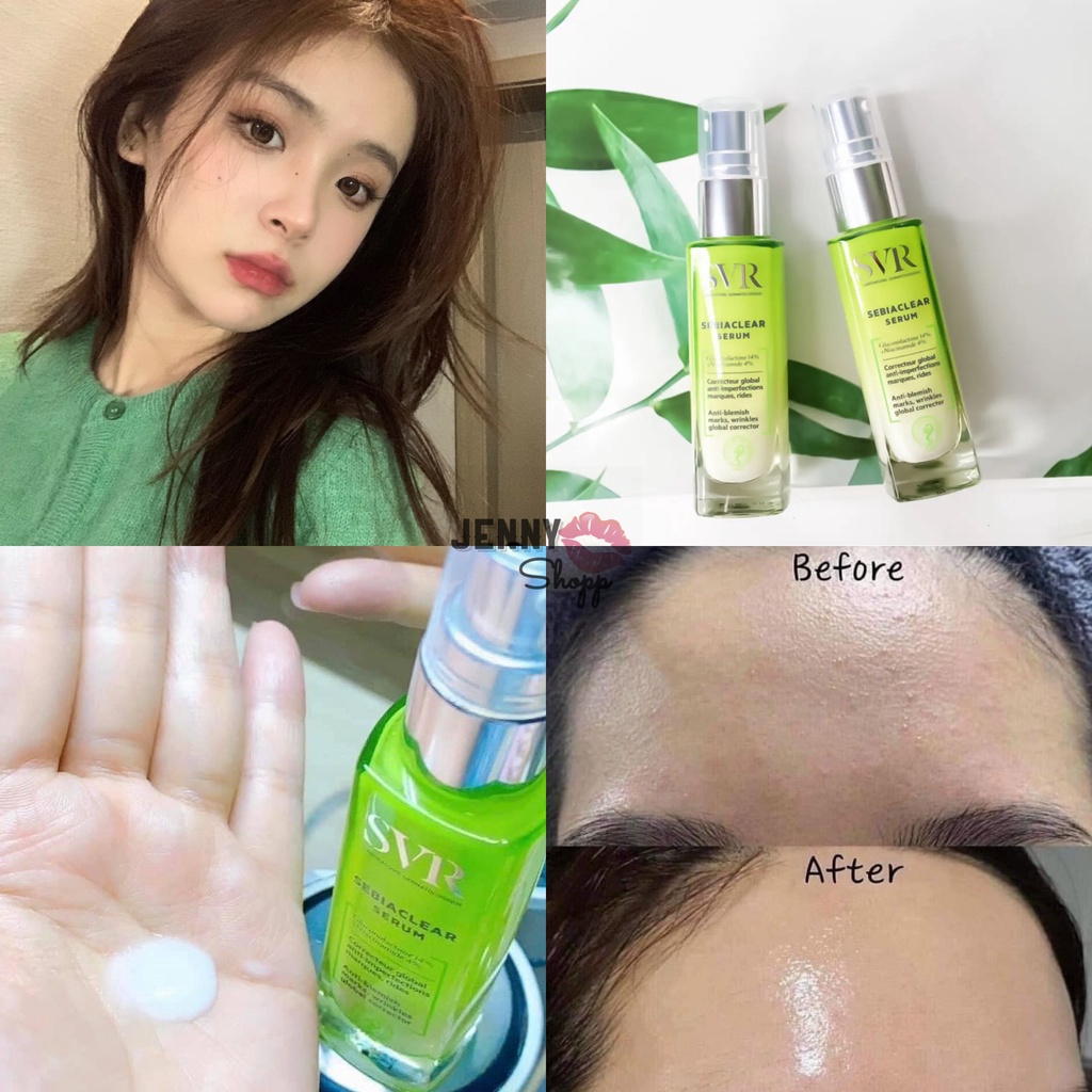 Tinh Chất Dưỡng SVR Sebiaclear Serum 30ml