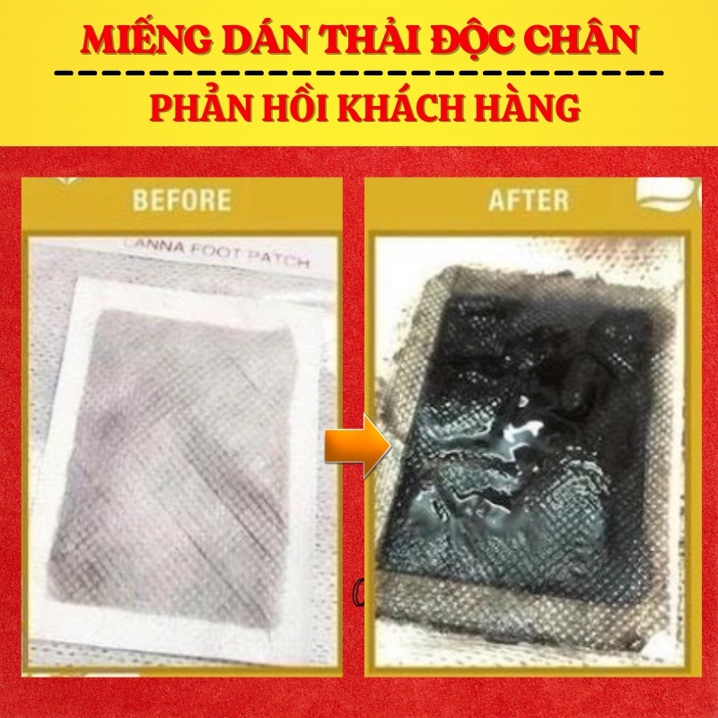 10 Miếng Dán Thải Độc Chân Thái Lan Detox Lanna Foot Patch