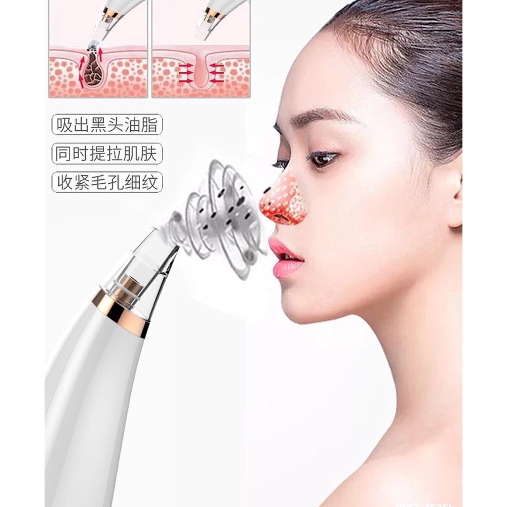 Máy hút mụn cám, mụn đầu đen cứng đầu, mụn trứng cá an toàn và vệ sinh, không gây tổn thương da, sử dụng pin
