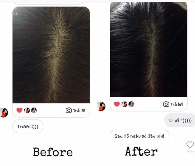 Tinh dầu bưởi kích mọc tóc - PRO Pomelo spray hair