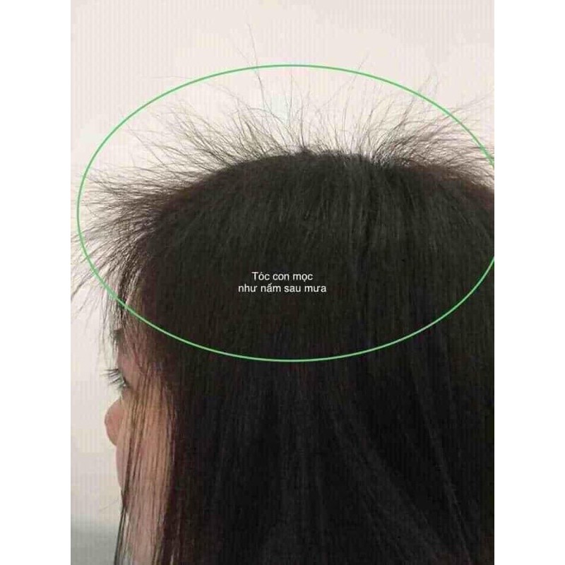 Tinh Dầu Bưởi VIJULLY [Kích Mọc Tóc] 100% Tự Nhiên | BigBuy360 - bigbuy360.vn