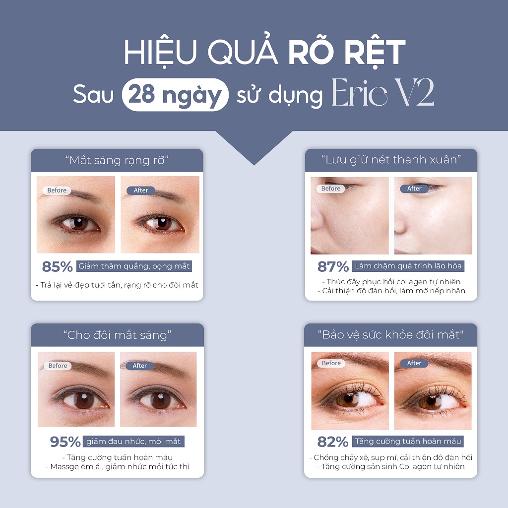 Máy Massage Mắt Cầm Tay Mini Nhiệt Rung Crénot Beauté Erie V2 Dụng cụ Mát Xa Quầng Thâm Mờ Nếp Nhăn Chống Lão Hóa