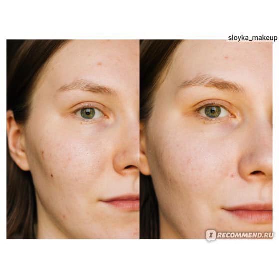 Serum Teana Blue Retinol Peel Da Căng Bóng Giảm Mụn, Làm Săn Chắc Mờ Thâm Nám Sẹo Và Trẻ Hoá Da 30ml