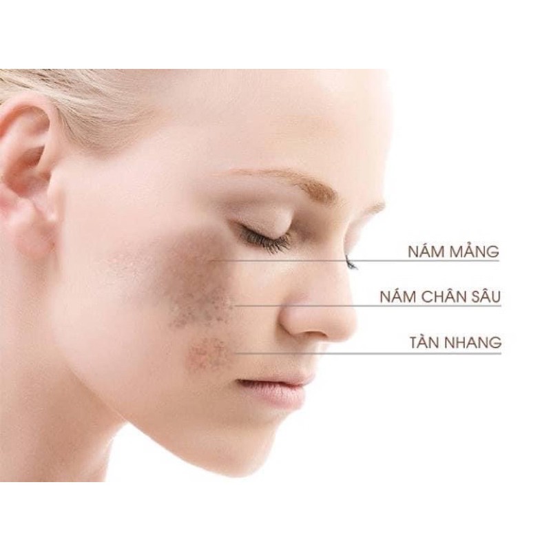 Kem nám Melasma Beaute MELASMA-X