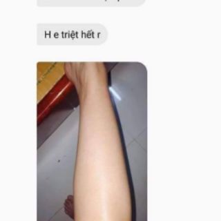 Combo triệt lông vĩnh viễn