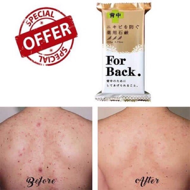 ❌XÀ PHÒNG TRỊ MỤN LƯNG, MỤN CƠ THỂ PELICAN FOR BACK CỦA NHẬT❌Có BILL Cam Kết CHÍNH HÃNG | BigBuy360 - bigbuy360.vn