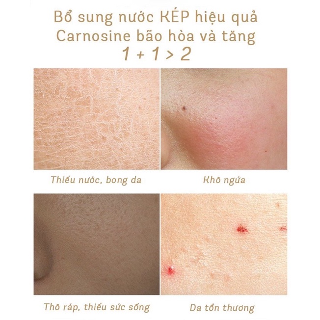 KEM DƯỠNG B5 Lucenbase