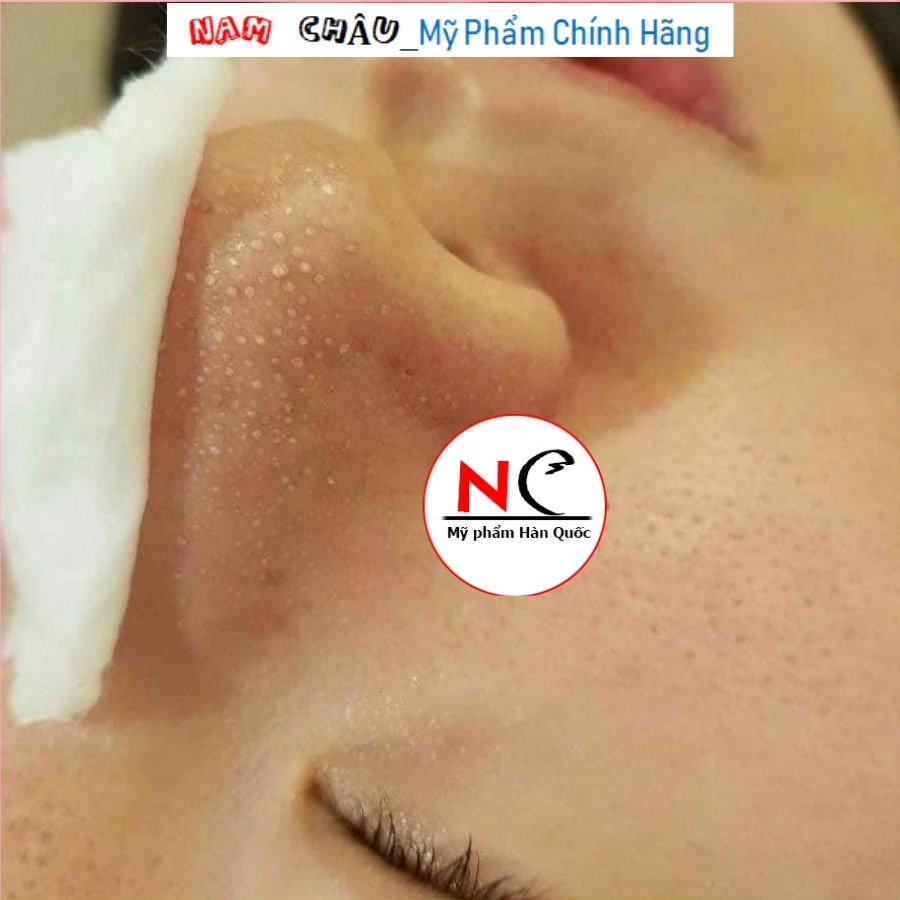 Ủ Mụn Đầu Đen Medi Peel Extra Super 9 Plus 50ml NPP Nam Châu