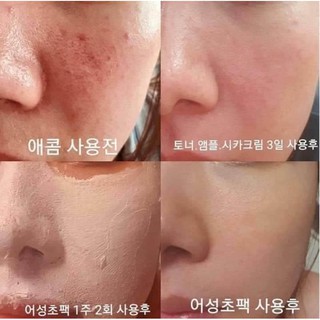 Mặt nạ đất sét Ki-eo
