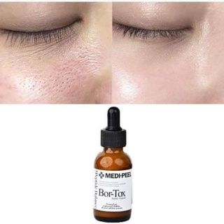 SERUM BOTOX MEDIPEEL