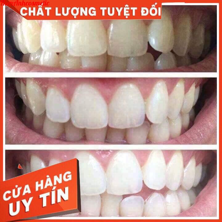 Kem đánh răng dược mỹ phẩm Dubur  Whitening Mint [𝑴𝒂̂̃𝒖 𝒎𝒐̛́𝒊 𝑨̂́𝒏 Đ𝒐̣̂] - Bảo vệ, tẩy trắng răng và đề phòng viêm nướu