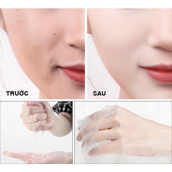 MẶT NẠ QUẢ BƠ CẤP ẨM LÀM DỊU LÀM MÁT PHỤC HỒI DA SAU TỔN THƯƠNG GIÚP MỜ THÂM THU NHỎ LỖ CHÂN LÔNG SamBeauty