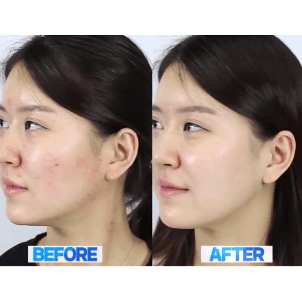 (NHẬP KHẨU) Tinh chất giảm mụn chiết xuất rau má Skin1004 Madagascar Centella Asiatica 100 Ampoule 55ml/100ml | BigBuy360 - bigbuy360.vn