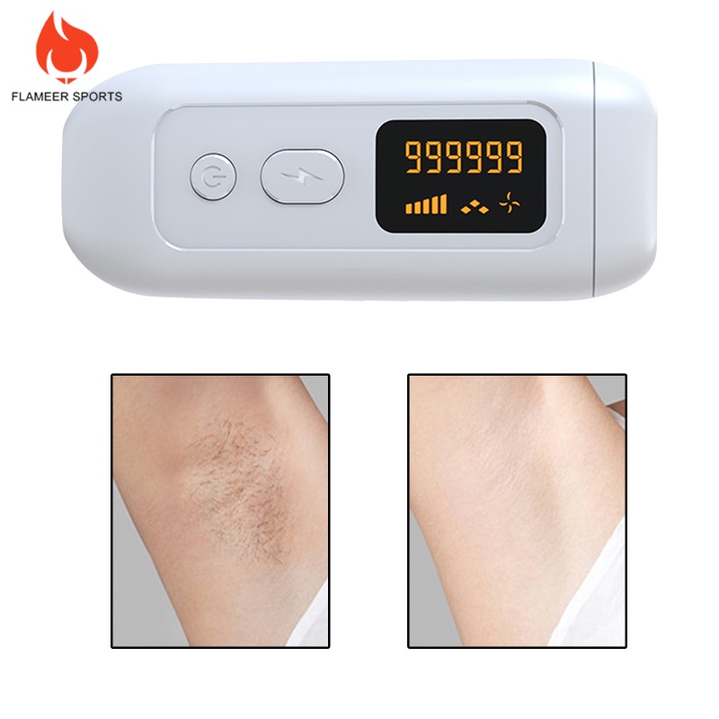 Flameer Sports  Laser Permanent Hair Removal Machine 990000 Flashes Epilator EU Plug