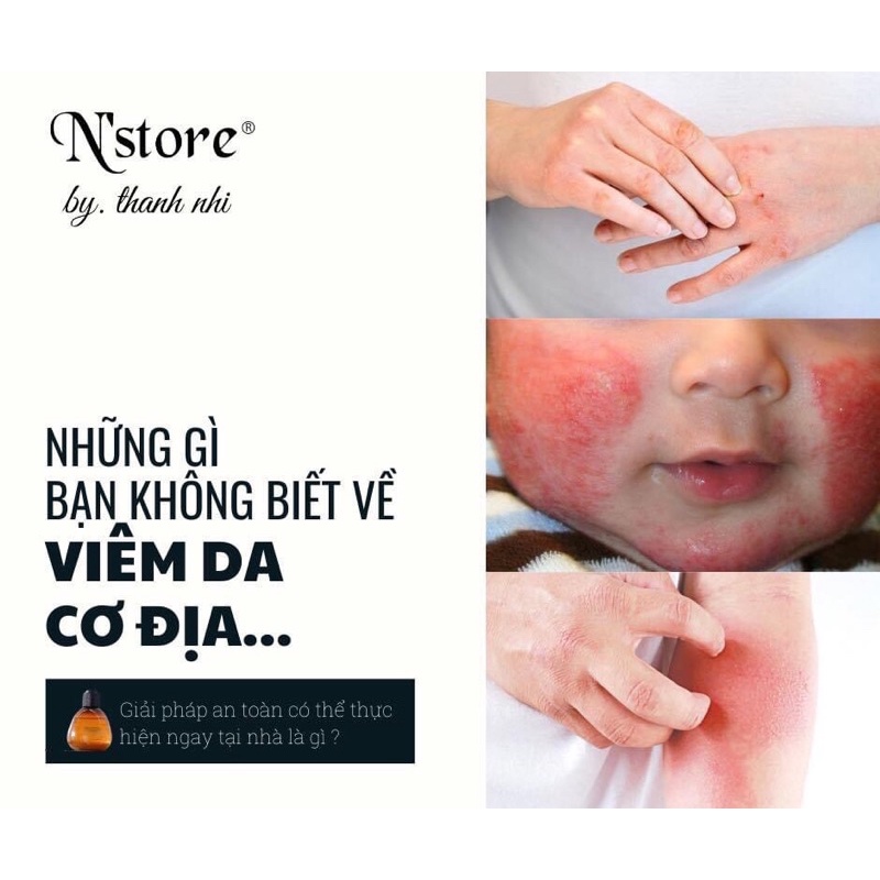 Mỡ trăn nguyên chất N'store mờ rạn da,lành vết bỏng, triệt lông vĩnh viễn tay, chân, nách,bikini an toàn