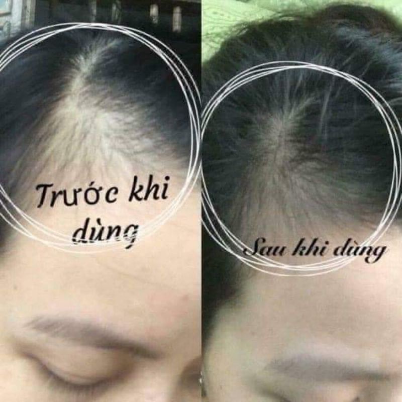 Viên dưỡng mọc tóc con Biotin Đức Mivolis giảm rụng