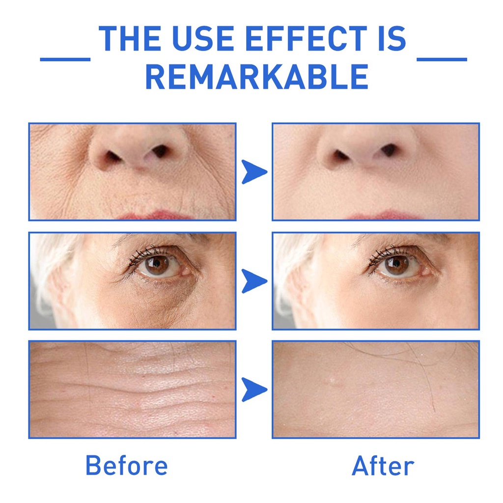 Serum Botox 30ml Chống Lão Hóa Và Nếp Nhăn Giúp Da Săn Chắc Trắng Sáng