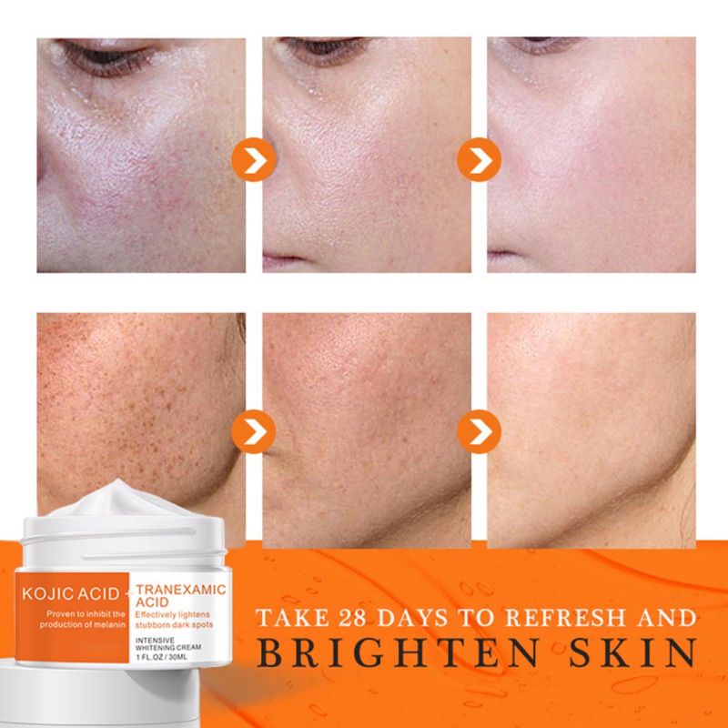 Kem Dưỡng Trắng Da Loại Bỏ Tàn Nhang Loại Bỏ Melanin Làm Sáng Da 30ml