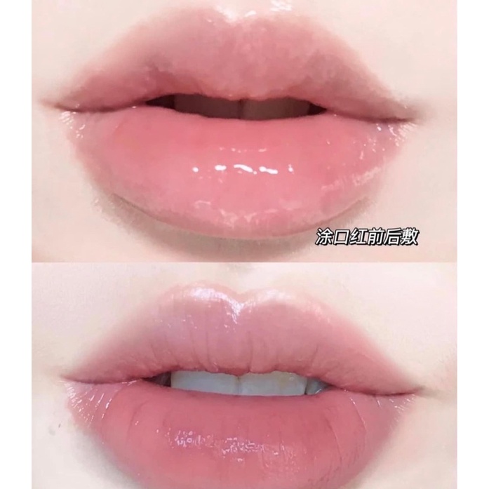 MẶT NẠ Ủ DƯỠNG MÔI YNM YOU NEED ME LIP TREAMENT PACK