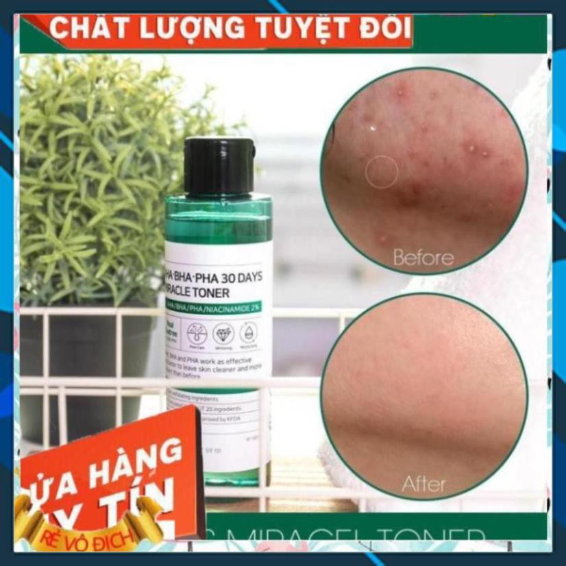 [FREESHIP]-Nước Hoa Hồng Giảm Mụn Some By Mi AHA-BHA-PHA 30 Days Miracle Toner 150ml | BigBuy360 - bigbuy360.vn