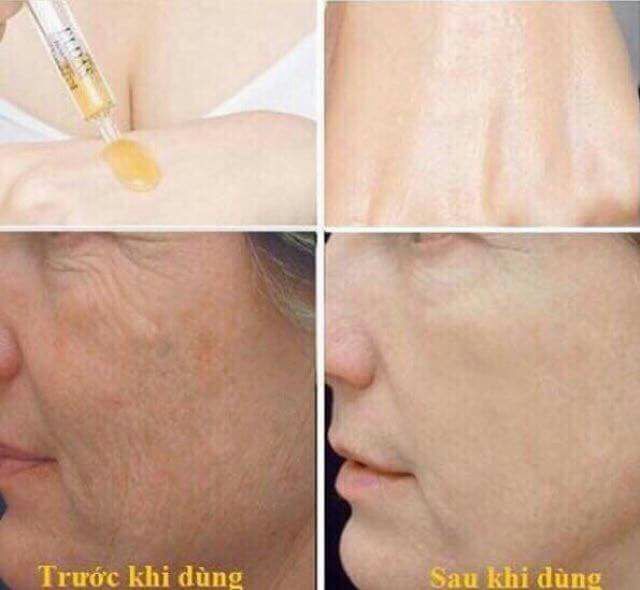 Serum Eldas Hàn quốc