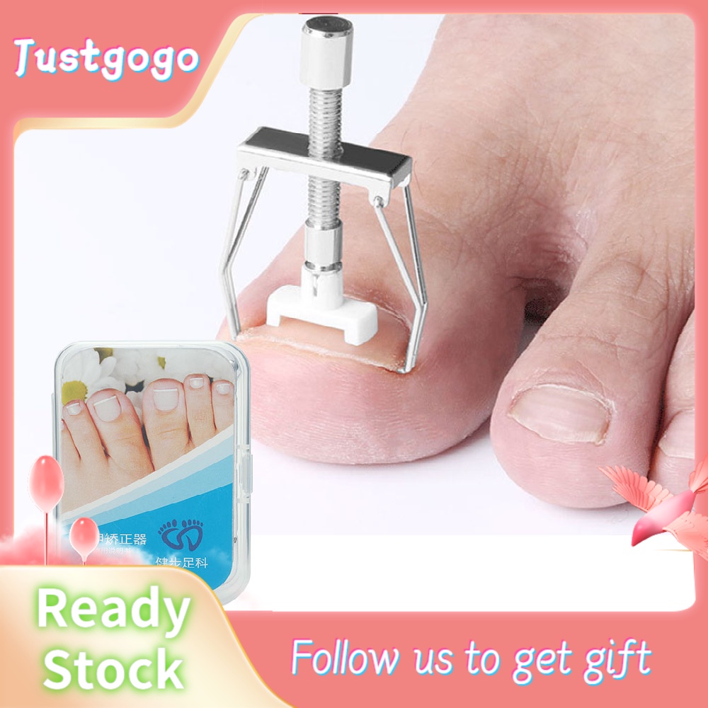 💥Ingown Toenail Fixer Điều chỉnh ngón chân Móng chân Viêm móng chân Corrector Bộ dụng cụ trị liệu chân