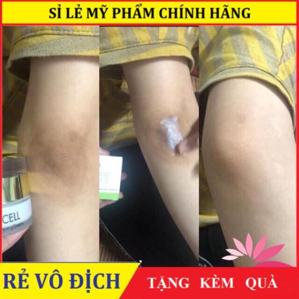 Kem xóa thâm nách - thâm đầu gối - giúp da trắng bớt mùi hôi nách hàn quốc