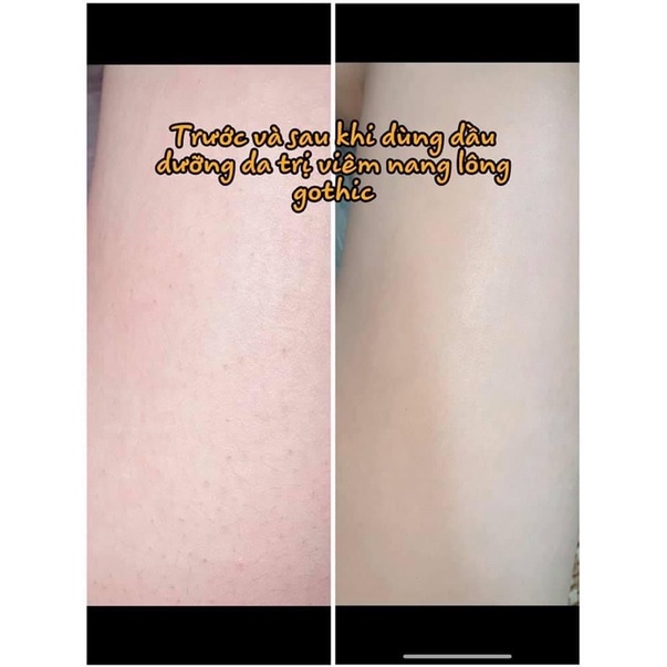 [chay 150ml] DẦU DƯỠNG BODY OIL GOTHIC | BigBuy360 - bigbuy360.vn