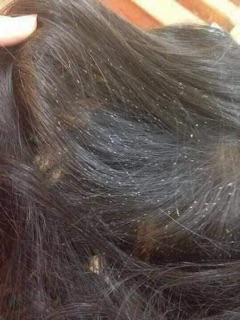 DẦU GỘI AnTi Thái Lan