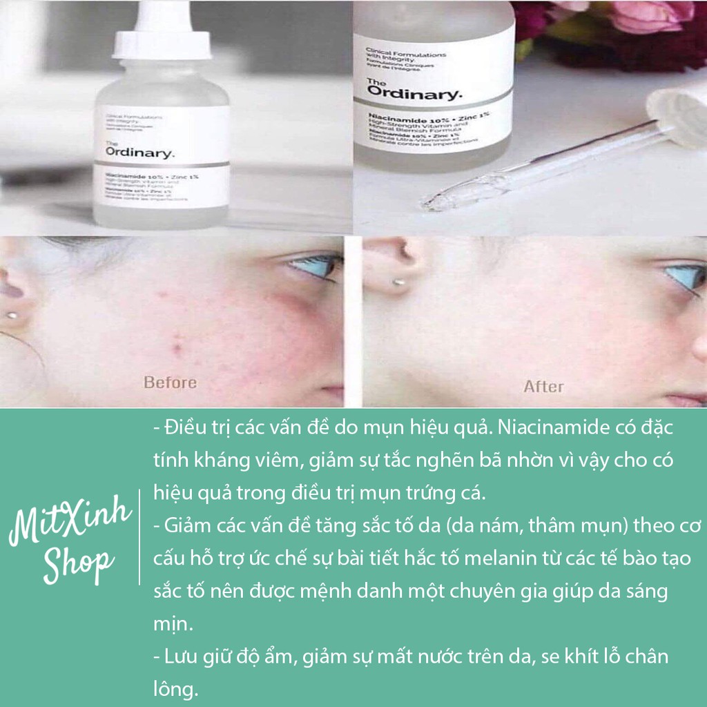 SERUM NGĂN NGỪA MỤN, SÁNG DA NIACINAMIDE 10% + ZINC 1% THE ORDINARY 30ML