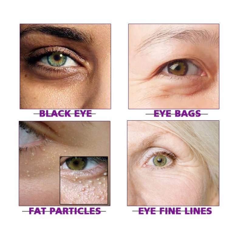 [Hàng mới về] Kem dưỡng mắt chiết xuất xoài chống nếp nhăn/bọng mắt xòa mờ quầng thâm dưỡng ẩm chống lão hóa RtopR 15g | BigBuy360 - bigbuy360.vn