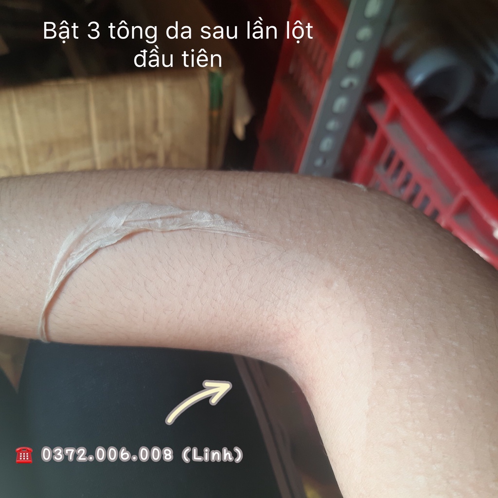 [Mua 2 hộp Tặng Kem Dưỡng] Nước Lột Da Thái Lan (mẫu mới bổ sung Collagen) - Thay da sinh học toàn thân